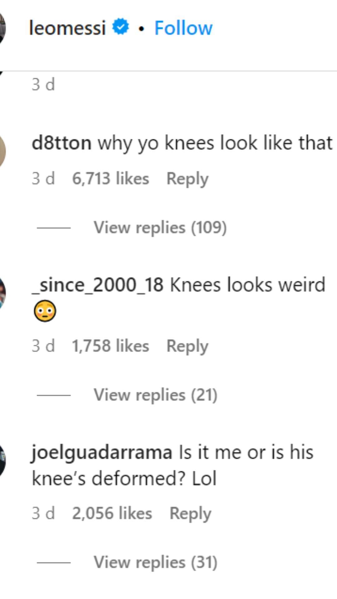 Fans are stunned by Messi's knees